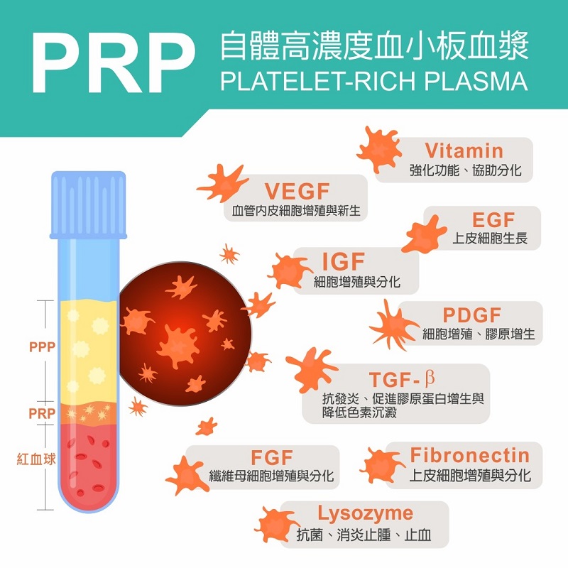 增生療法 ,增生療法 費用,增生療法 台北, 增生療法 副作用, 增生療法 注射, 增生療法 推薦 ,PRP注射,治療,增生治療,增生療法,增生 注射,功效,治療費用,修復軟組織,治療疼痛,脊椎關節,骨骼肌肉疾病,肩頸痠痛,下背痛,網球肘,退化性關節炎,足底筋膜炎,踝關節肌腱韌帶扭傷,復健專科,自體血小板,離心機,血液分離,高濃度血小板血漿,組織再生,減緩發炎,再生療法