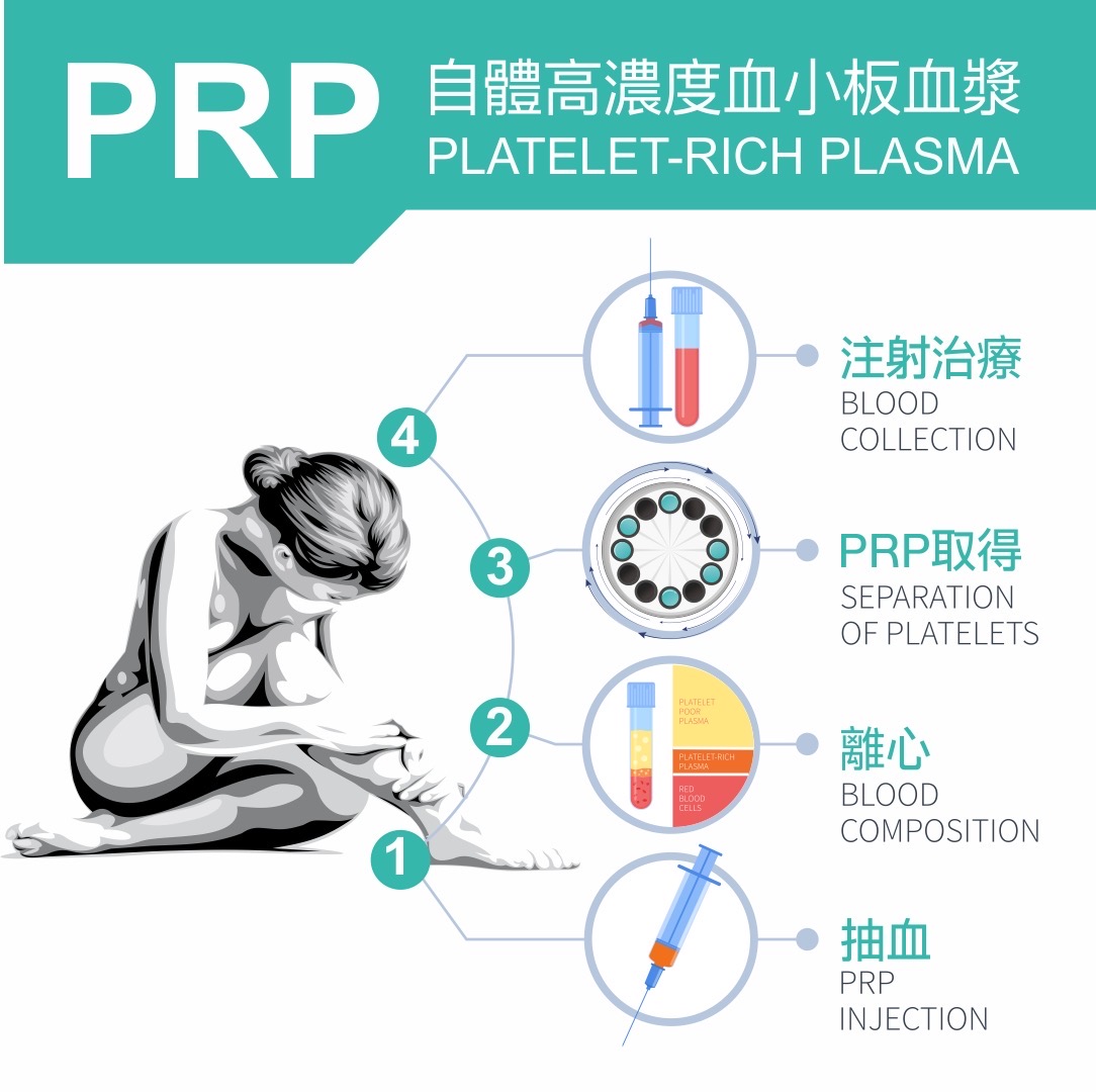 再生療法,再生醫學,再生療法PRP,PRP治療,痛的想死怎麼辦