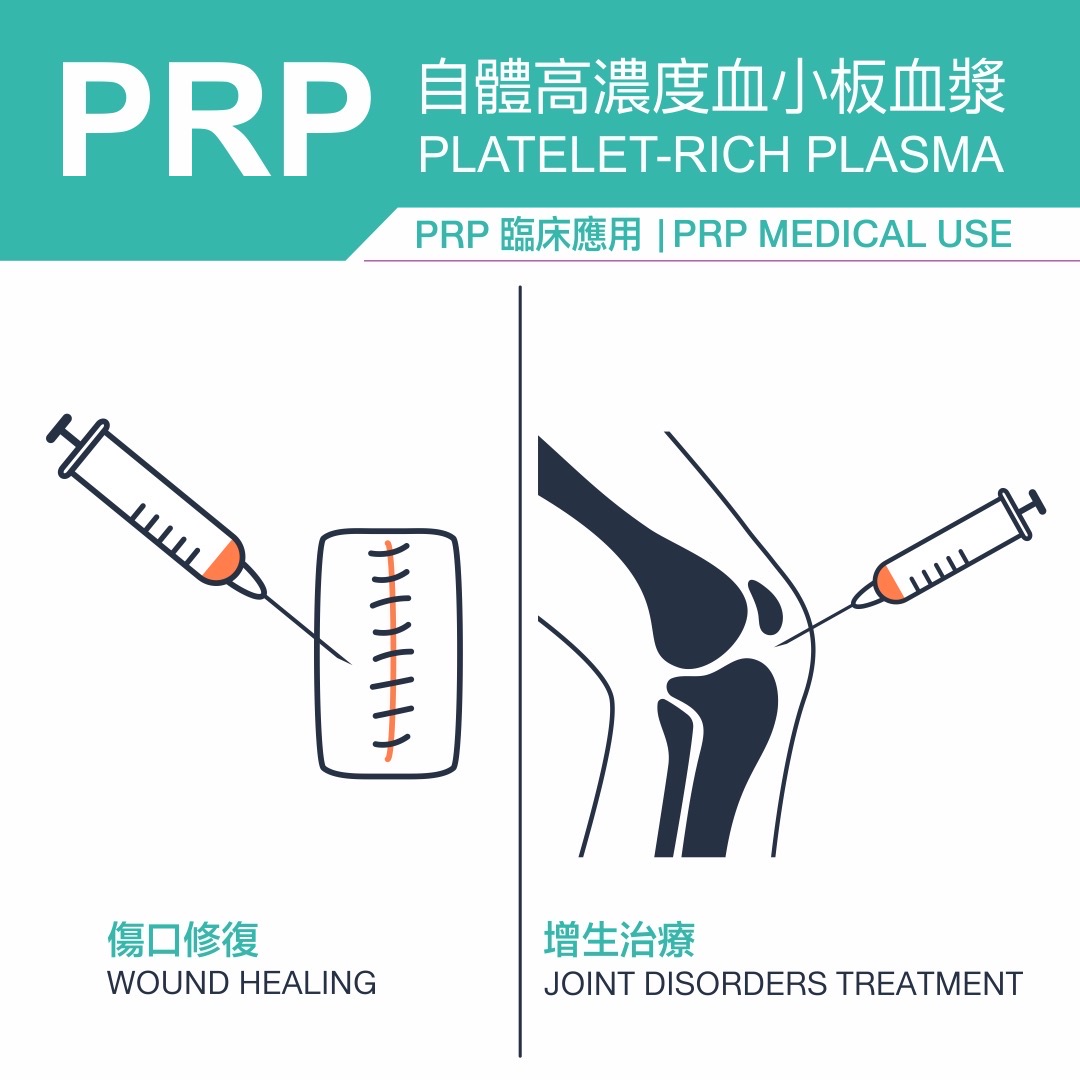 肌腱炎,鈣化性肌腱炎,肌腱 炎治療,肩膀痛,肌腱炎症狀,肌腱炎看哪科,肩膀痛原因,肌 腱炎舒緩,右肩疼痛,左肩疼痛 . 肌腱炎,鈣化性肌腱炎,肌腱炎治療,肩膀痛,肌腱炎症狀,肌腱炎看哪科,肩膀痛原因,肌腱炎舒緩,右肩疼痛,左肩疼痛