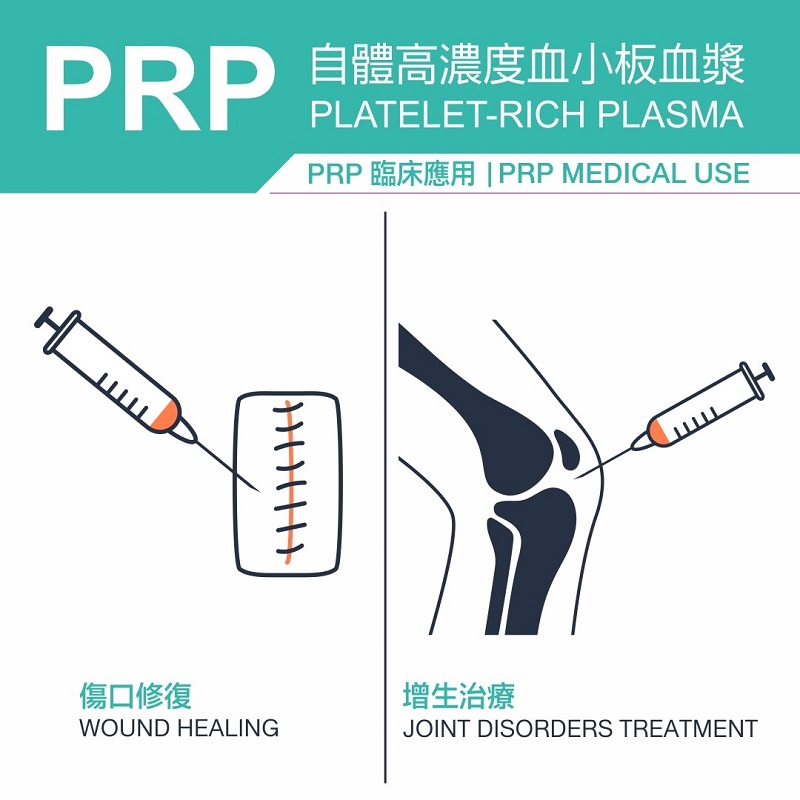 增生療法 ,增生療法 費用,增生療法 台北, 增生療法 副作用, 增生療法 注射, 增生療法 推薦 , PRP注射,治療,增生治療,增生療法,增生 注射,功效,治療費用,修復軟組織,治療疼痛,脊椎關節,骨骼肌肉疾病,肩頸痠痛,下背痛,網球肘,退化性關節炎,足底筋膜炎,踝關節肌腱韌帶扭傷,復健專科,自體血小板,離心機,血液分離,高濃度血小板血漿,組織再生,減緩發炎,再生療法